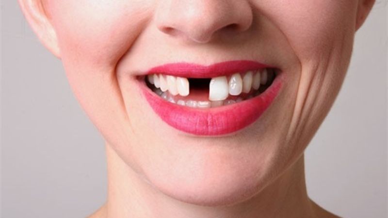 Mơ thấy rụng răng có những trường hợp nào?